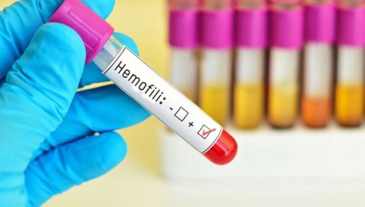 Prof. Dr. Birol Baytan: Hemofili ekseriyetle sünnet sonrası ortaya çıkıyor