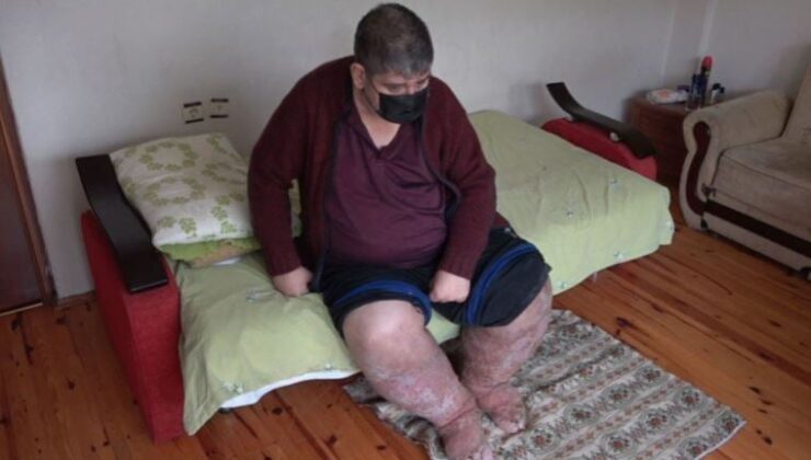 Sivrisineğin ısırdığı güvenlik vazifelisi hayatını kaybetti