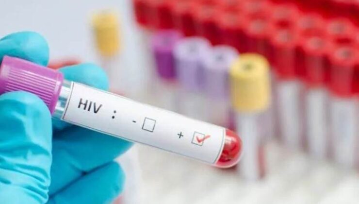 HIV erken teşhis ve tedaviyle “yönetilebilir” bir hastalık